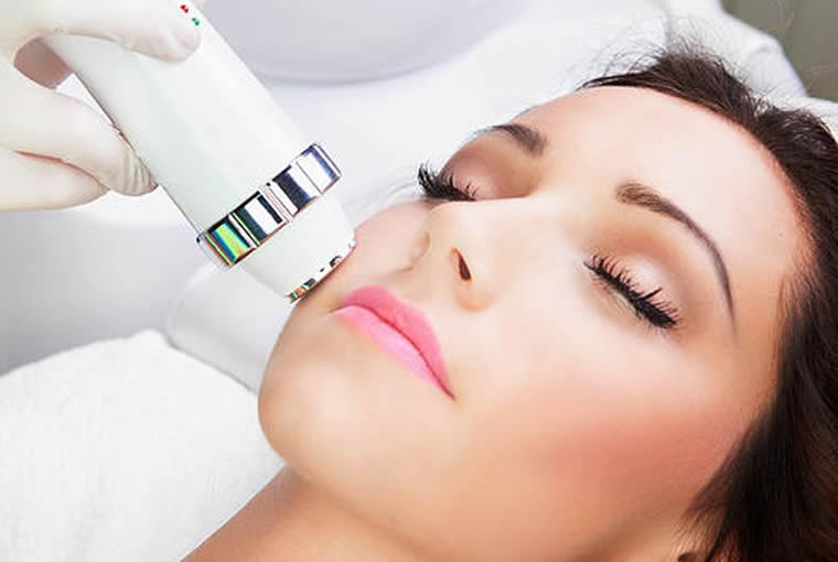 redio-frecuencia-facial redio frecuencia facial